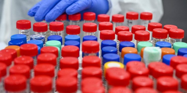 London not shielded from Ontario’s COVID-19 hot spots, says top public health official