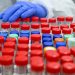 London not shielded from Ontario’s COVID-19 hot spots, says top public health official